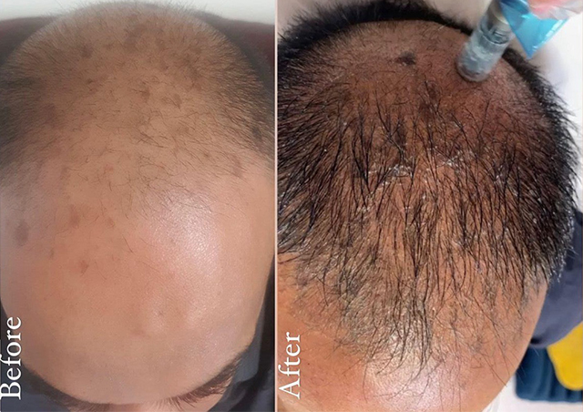 before-and-after